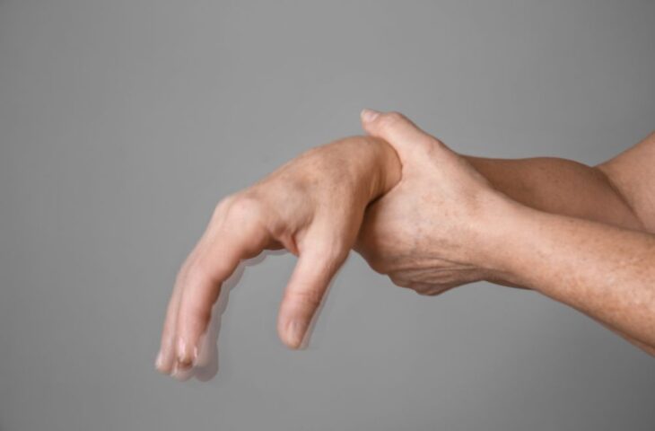 Parkinson