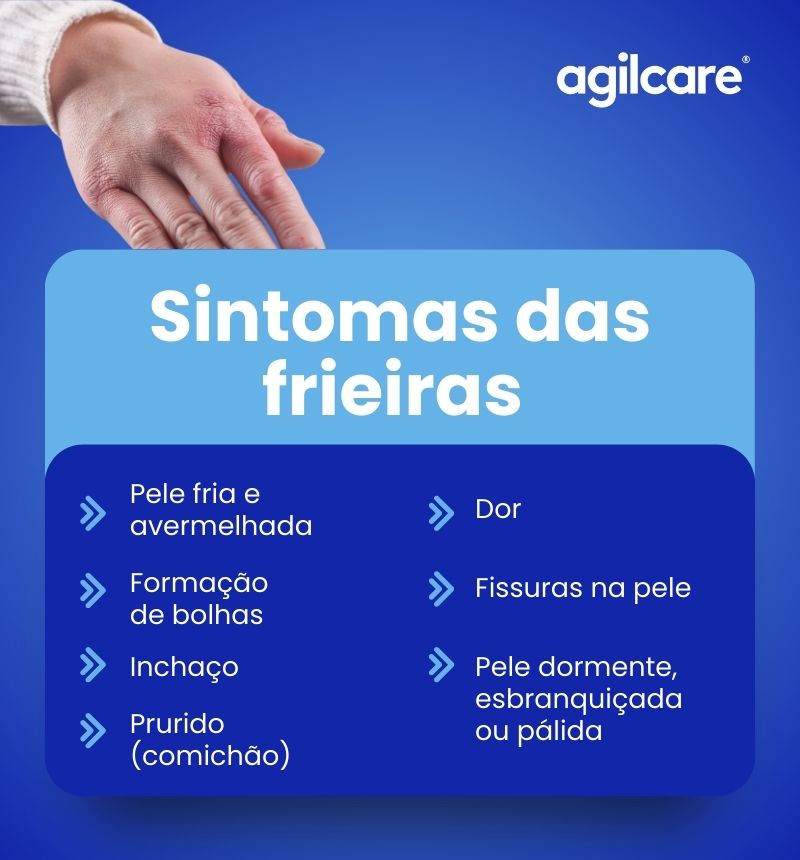 Frieiras-sintomas