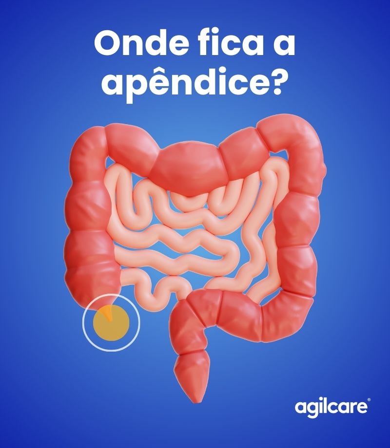 Apendicite