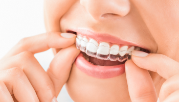 aparelho dentario invisivel agilcare