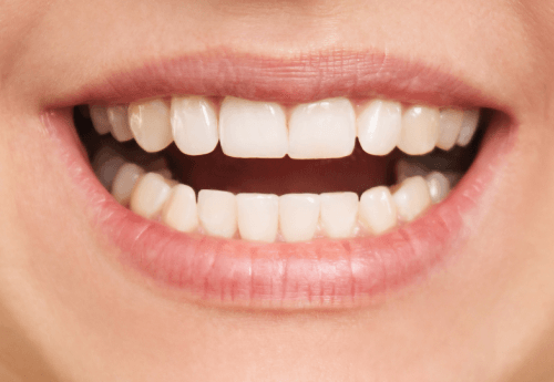 aparelho dentario agilcare