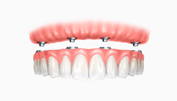 prótese dentária agilcare