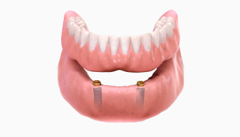 prótese dentária agilcare