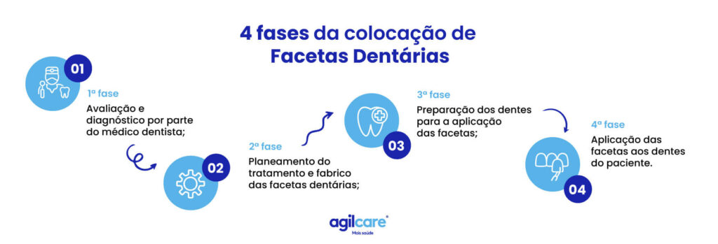 facetas dentarias agilcare