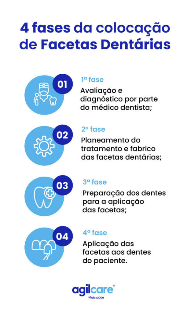 facetas dentarias agilcare