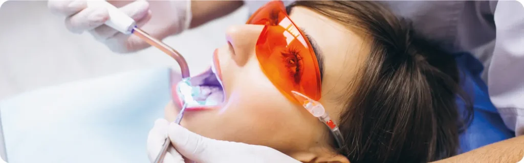 branqueamento dentario agilcare