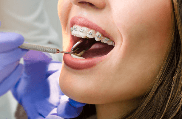 aparelho dentario plano dental agilcare