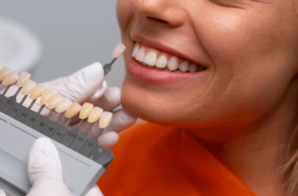 facetas dentarias plano dental agilcare