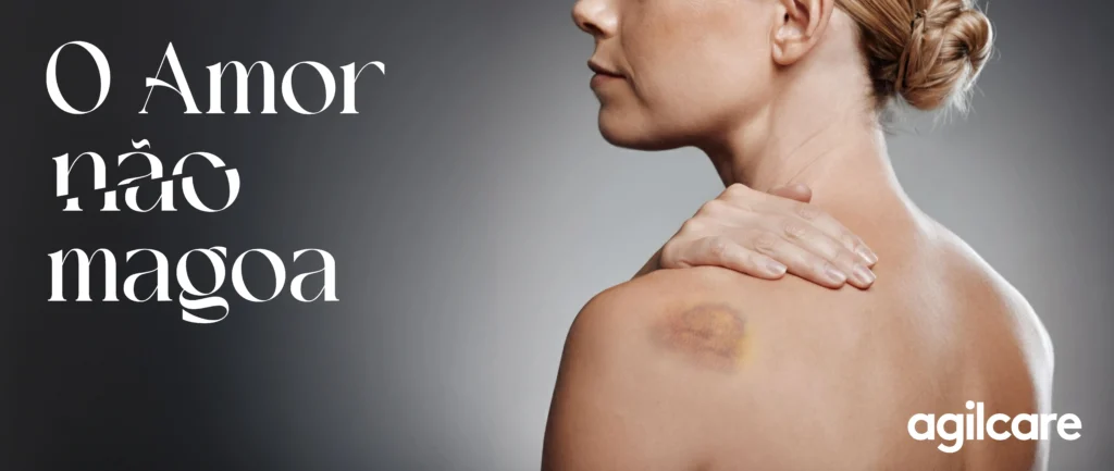 Campanha "Amor não Magoa" - Imprensa
