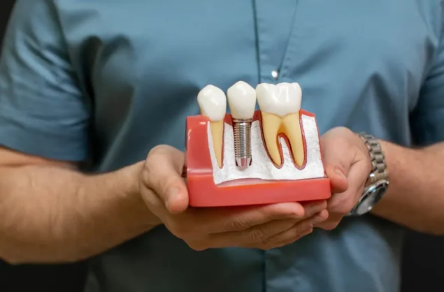 Implantes Dentários: que tipos existem?